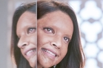 Deepika Padukone, Deepika Padukone new look, first look of deepika padukone as acid attack survivor, Padmaavat