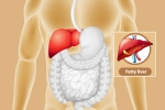 Fatty Liver cure, Fatty Liver news, dangers of fatty liver, Lifestyle