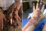 henna, henna tattoo, henna tattoo cause aussie woman to almost lose her hand, Tattoos